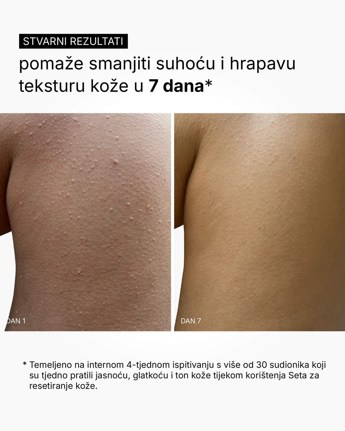 A Flattering Drop - Testszérum