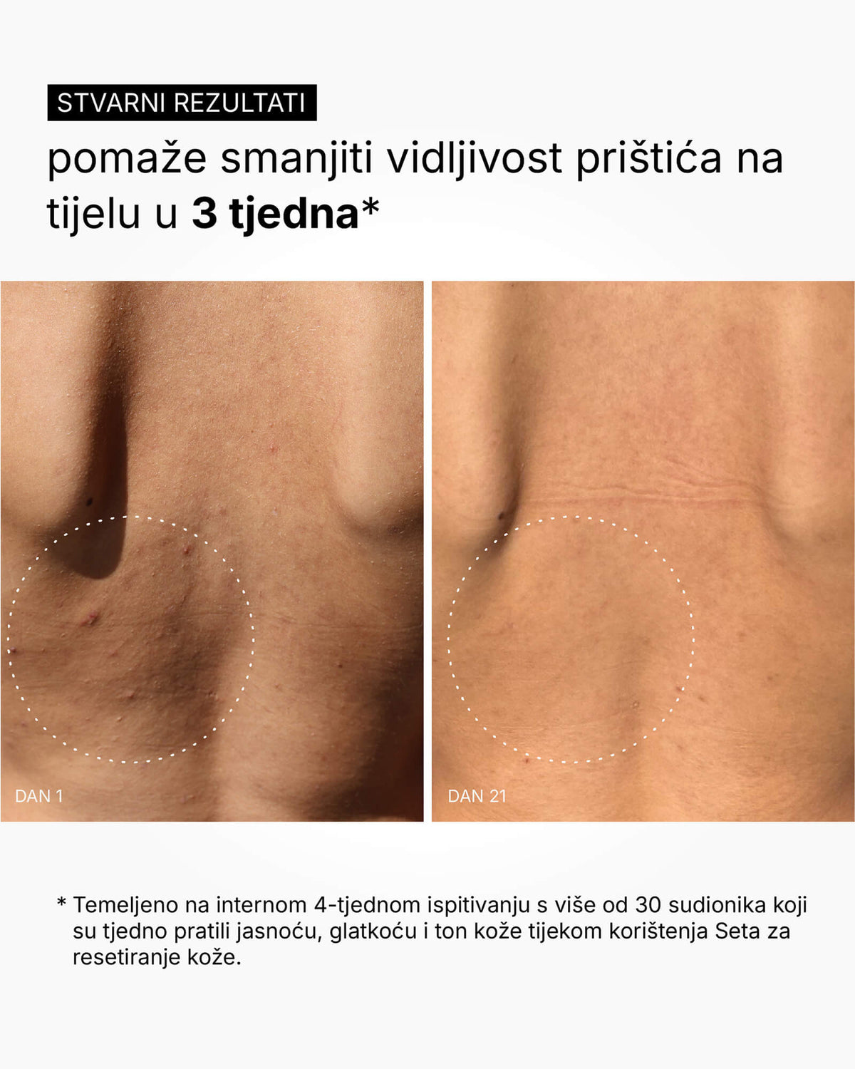 A Flattering Drop - Testszérum