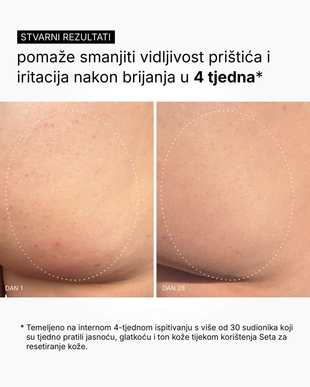 A Flattering Drop - Testszérum